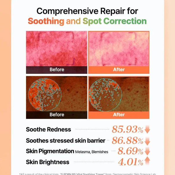 COSRX 5 PDRN B5 Vital Soothing Toner 280 ML COSRX JOLIE'S