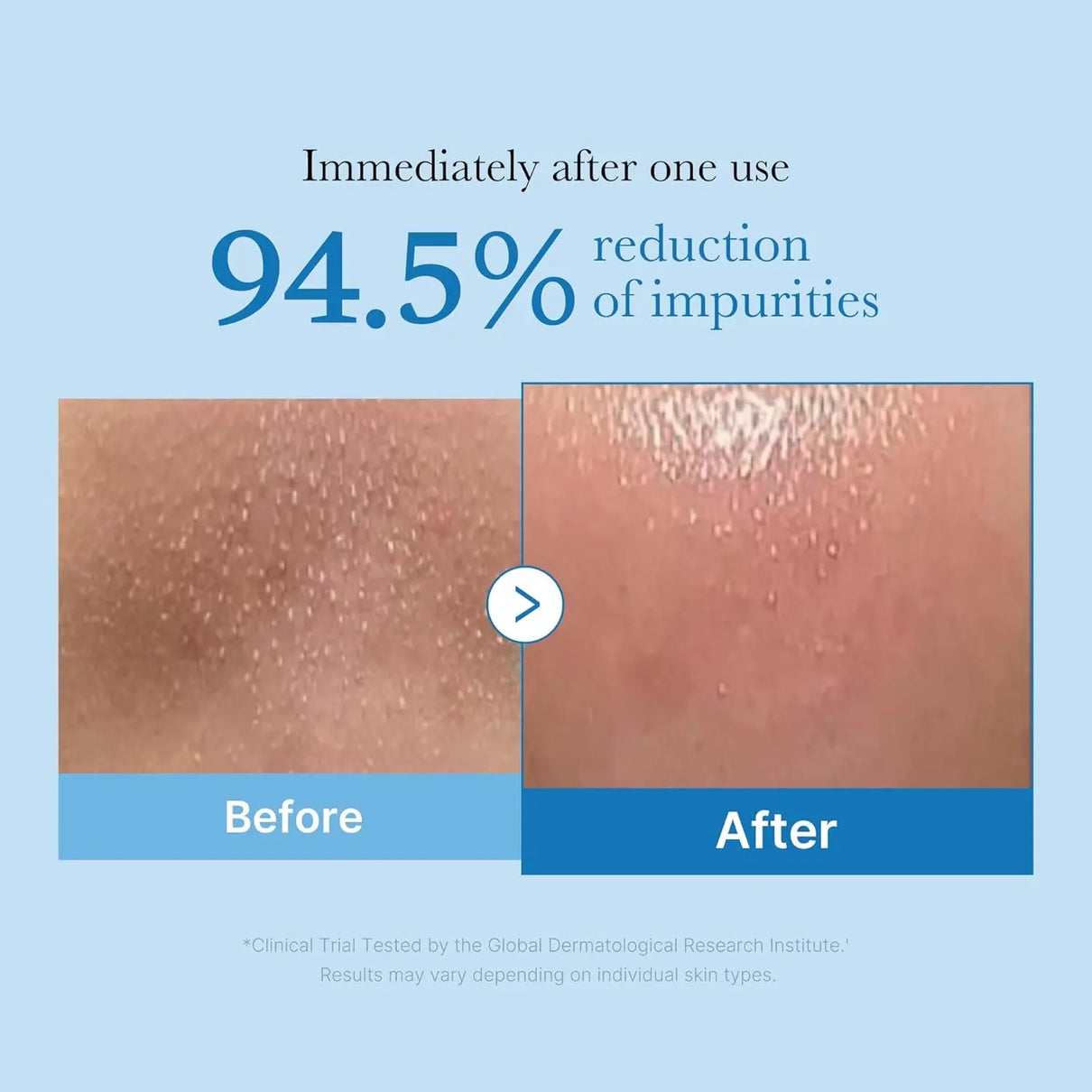 MEDICUBE Zero Pore Blackhead Deep Cleansing Oil Medicube JOLIE'S