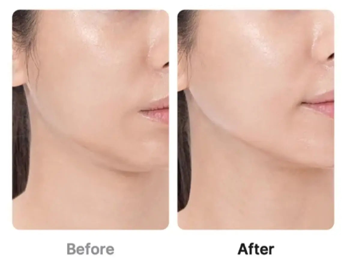 Medicube Age-R Booster Pro (154g) Medicube JOLIE'S