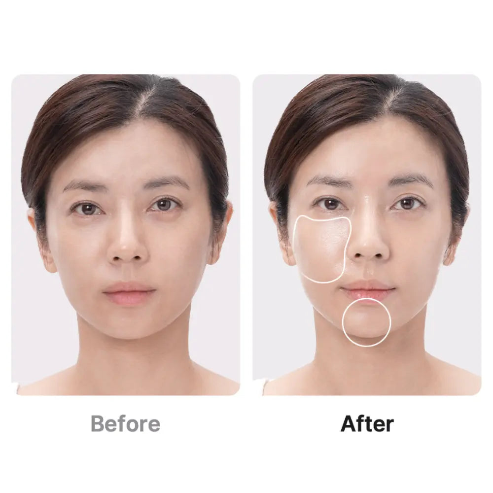 Medicube Age-R Booster Pro (154g) Medicube JOLIE'S