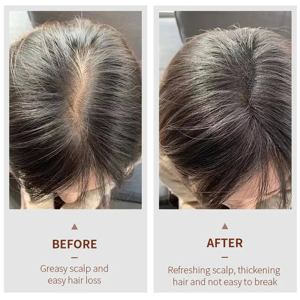 NUSPA Anti Hair Loss Hair Care Set with Herbal Shampoo, Serum & Massage Comb NUSPA JOLIE'S