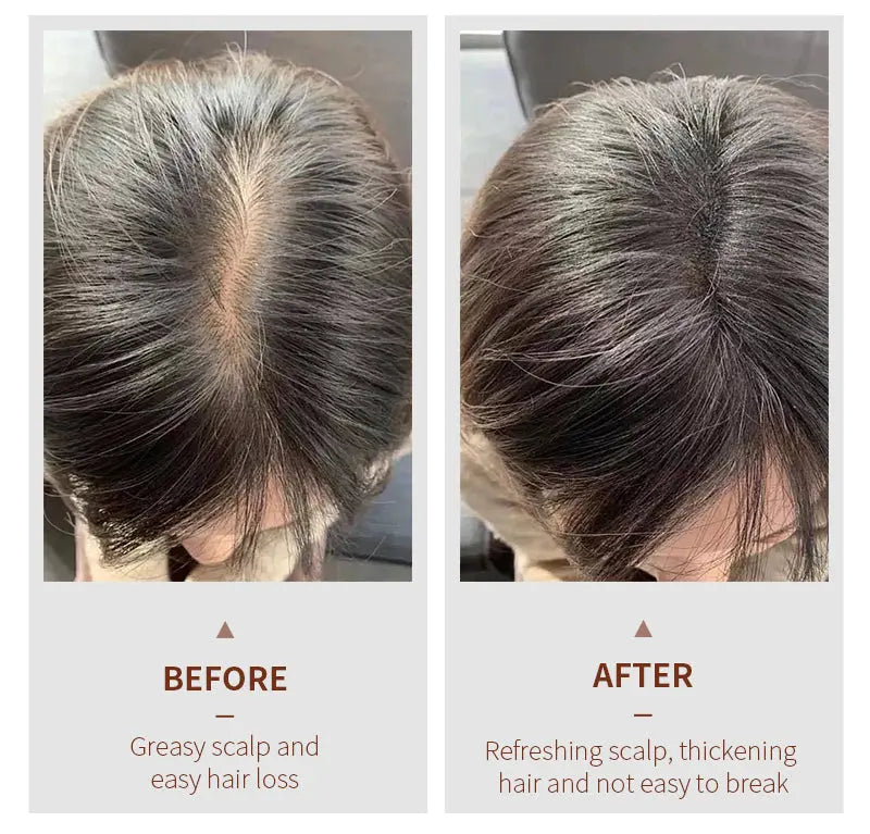 NUSPA Anti Hair Loss Hair Care Set with Herbal Shampoo, Serum & Massage Comb NUSPA JOLIE'S